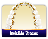 Incognito Invisible Braces