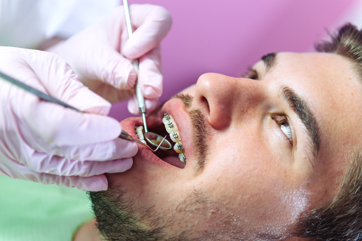 dental assistant's hands using tools in man's mouth to examine braces, orthodontist Melrose, MA