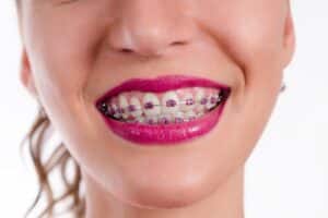 What Is the Difference Between an Orthodontist and a Dentist in Gurnee, IL? Honey Orthodontics